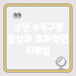 성인 수족구병 증상과 효과적인 치료법